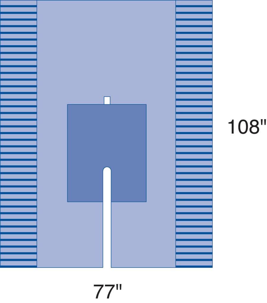 Medline Sterile Orthopedic Surgical Pack I, Eclipse
