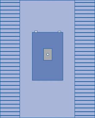 Medline Sterile Minor Extremity Surgical Pack, Sirus