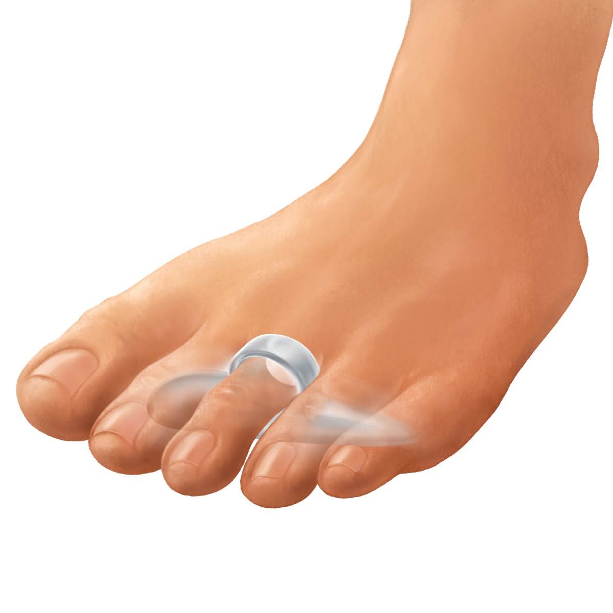 Medline Gel Hammer Toe Crest