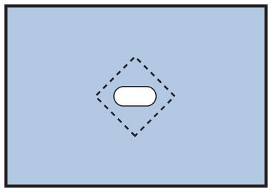 Medline Nonsterile Minor Procedure Drapes