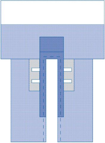 Medline Sterile Cardiovascular Split Drapes with Clear Anesthesia Screen and Pouch