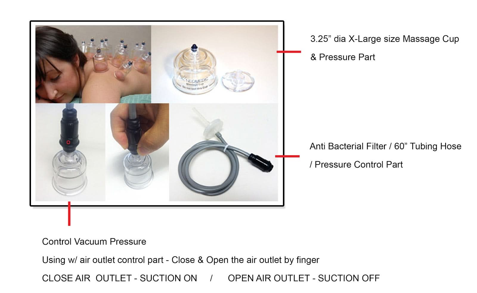 Neomedic REGULAR ELECTRIC CUPPING SET