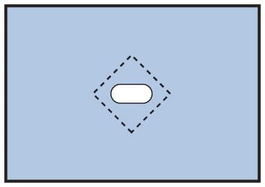 Medline Medline Nonsterile Minor Procedure Drapes 66796